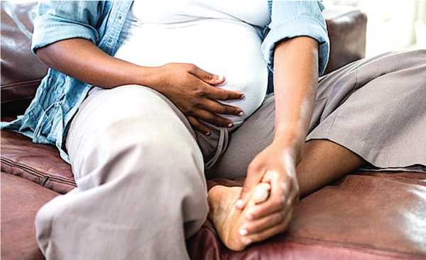 MANAGING OEDEMA in pregnancy