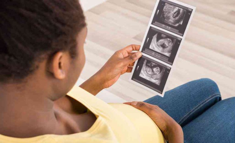 Love your ultrasounds (part 2)