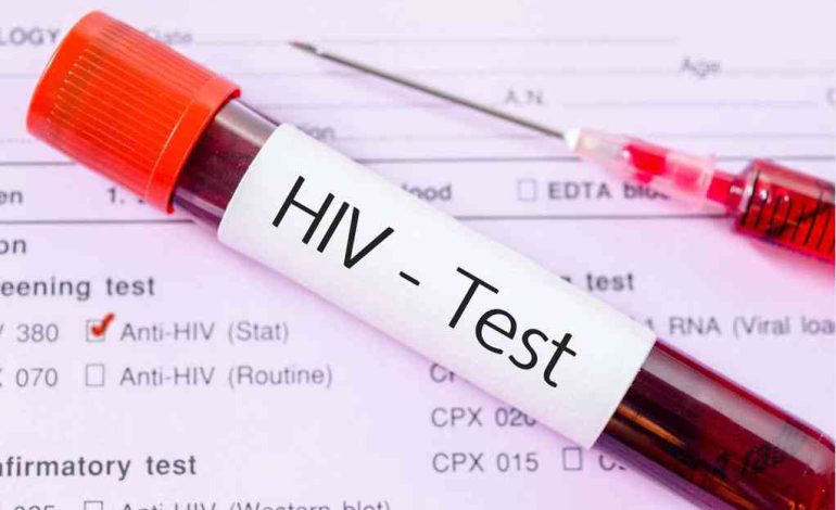 HIV/AIDS epidemic is almost contained in Kenya – UN report