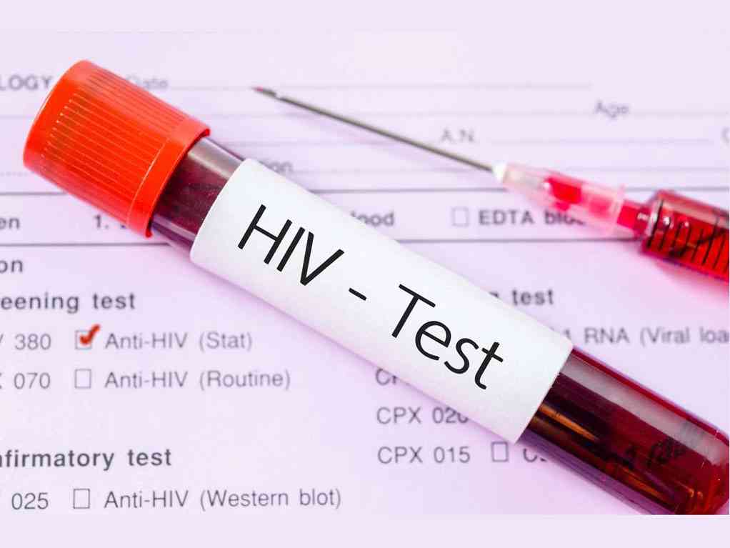 HIV/AIDS epidemic is almost contained in Kenya – UN report