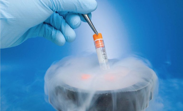 What you need to know about egg freezing