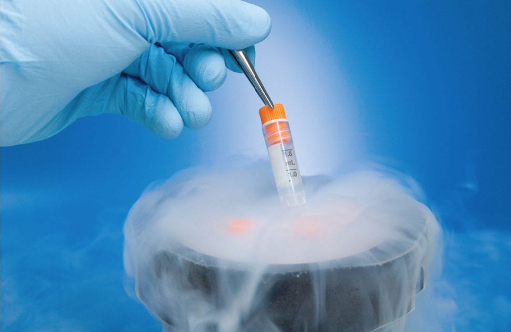 What you need to know about egg freezing